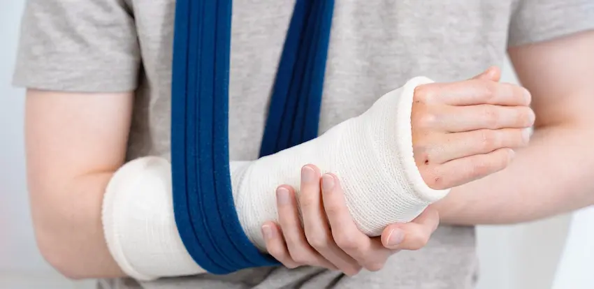 A personal injury attorney represents clients with broken bones and fractures requiring medical treatment and compensation.